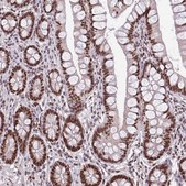 Anti-TTF1 antibody produced in rabbit Prestige Antibodies® Powered by Atlas Antibodies, affinity isolated antibody, buffered aqueous glycerol solution
