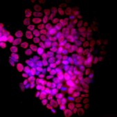 Fluorescent Mouse ES/iPS Cell Characterization Kit This Fluorescent Mouse ES/iPS Cell Characterization Kit contains a range of sensitive tools for the phenotypic assessment of the pluripotent status of mouse Embryonic stem &amp; induced pluripotent Stem cells.