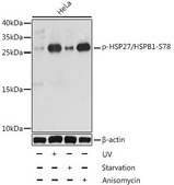 Anti-Phospho-HSP27/HSPB1-S78 antibody produced in rabbit