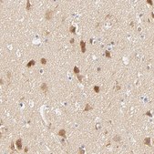 Anti-SULT4A1 antibody produced in rabbit Prestige Antibodies® Powered by Atlas Antibodies, affinity isolated antibody, buffered aqueous glycerol solution