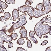 Anti-SKP2 antibody produced in rabbit Prestige Antibodies® Powered by Atlas Antibodies, affinity isolated antibody, buffered aqueous glycerol solution