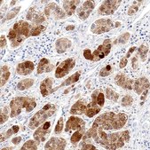 Anti-OTC antibody produced in rabbit Prestige Antibodies® Powered by Atlas Antibodies, affinity isolated antibody, buffered aqueous glycerol solution