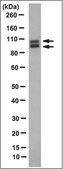 Anti-B-cell lymphoma/leukemia 11B, clone 3A8.2 Antibody clone 3A8.2, from mouse