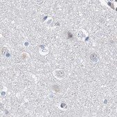 Anti-UIMC1 antibody produced in rabbit Prestige Antibodies® Powered by Atlas Antibodies, affinity isolated antibody, buffered aqueous glycerol solution