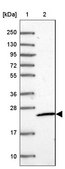 Anti-MRPS26 antibody produced in rabbit Prestige Antibodies® Powered by Atlas Antibodies, affinity isolated antibody, buffered aqueous glycerol solution