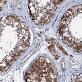 Anti-TRAFD1 antibody produced in rabbit Prestige Antibodies® Powered by Atlas Antibodies, affinity isolated antibody, buffered aqueous glycerol solution