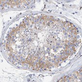 Anti-MAP1B antibody produced in rabbit Prestige Antibodies® Powered by Atlas Antibodies, affinity isolated antibody, buffered aqueous glycerol solution