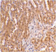 Anti-TIRP Antibody from rabbit, purified by affinity chromatography