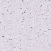 Anti-TFF2 antibody produced in rabbit Prestige Antibodies® Powered by Atlas Antibodies, affinity isolated antibody, buffered aqueous glycerol solution