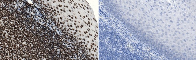 Anti-DNA/Histone H1 Antibody Chemicon&#174;, from mouse