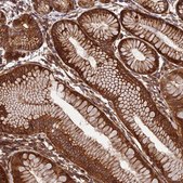Anti-EVI5L antibody produced in rabbit Prestige Antibodies® Powered by Atlas Antibodies, affinity isolated antibody, buffered aqueous glycerol solution