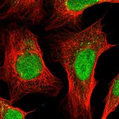 Anti-ZFP37 antibody produced in rabbit Prestige Antibodies® Powered by Atlas Antibodies, affinity isolated antibody, buffered aqueous glycerol solution