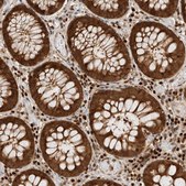 Anti-SNRNP40 antibody produced in rabbit Prestige Antibodies® Powered by Atlas Antibodies, affinity isolated antibody, buffered aqueous glycerol solution