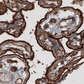 Monoclonal Anti-EZR antibody produced in mouse Prestige Antibodies® Powered by Atlas Antibodies, clone CL2378, purified immunoglobulin, buffered aqueous glycerol solution