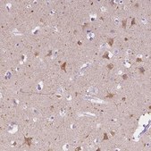 Anti-CHRM1 antibody produced in rabbit Prestige Antibodies® Powered by Atlas Antibodies, affinity isolated antibody, buffered aqueous glycerol solution