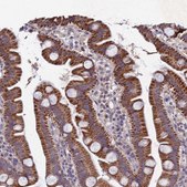 Anti-CHST5 antibody produced in rabbit Prestige Antibodies® Powered by Atlas Antibodies, affinity isolated antibody, buffered aqueous glycerol solution