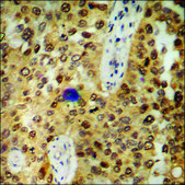 Anti-phospho-ATF2 (pThr69 or 51) antibody produced in rabbit affinity isolated antibody