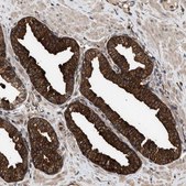 Anti-ZNHIT6 antibody produced in rabbit Prestige Antibodies® Powered by Atlas Antibodies, affinity isolated antibody, buffered aqueous glycerol solution