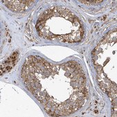 Anti-TRAIP antibody produced in rabbit Prestige Antibodies® Powered by Atlas Antibodies, affinity isolated antibody, buffered aqueous glycerol solution