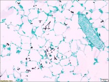 Sodium Thiosulfate Solution 2 g/dL in deionized water