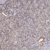 Anti-BRCA1 Prestige Antibodies® Powered by Atlas Antibodies, affinity isolated antibody