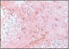 Anti-Glial Fibrillary Acidic Protein antibody produced in rabbit IgG fraction of antiserum, buffered aqueous solution