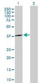 Anti-SPO11 antibody produced in rabbit purified immunoglobulin, buffered aqueous solution