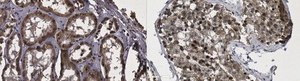 Anti-CLCA4 Antibody, clone 1C5.1 clone 1C5.1, from mouse