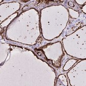 Anti-CHMP1B antibody produced in rabbit Prestige Antibodies® Powered by Atlas Antibodies, affinity isolated antibody, buffered aqueous glycerol solution