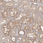 Anti-CHMP4C antibody produced in rabbit affinity isolated antibody, buffered aqueous glycerol solution