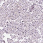 Anti-IMMT antibody produced in rabbit Prestige Antibodies® Powered by Atlas Antibodies, affinity isolated antibody, buffered aqueous glycerol solution
