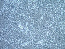 TS/A Mouse Mammary Adenocarcinoma Cell Line TS/A mouse mammary adenocarcinoma cell line is a well characterized and highly published model for breast cancer research.