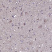 Anti-OR2W3 antibody produced in rabbit Prestige Antibodies® Powered by Atlas Antibodies, affinity isolated antibody, buffered aqueous glycerol solution