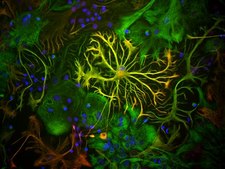 Anti-Glial Fibrillary Acidic Protein Antibody Chemicon®, from chicken