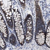 Anti-TBRG4 antibody produced in rabbit Prestige Antibodies® Powered by Atlas Antibodies, affinity isolated antibody, buffered aqueous glycerol solution
