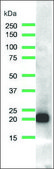 Anti-N-RAS antibody, Rabbit monoclonal recombinant, expressed in proprietary host, clone SP174, affinity isolated antibody