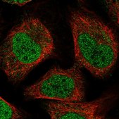 Anti-MBD6 antibody produced in rabbit Prestige Antibodies® Powered by Atlas Antibodies, affinity isolated antibody, buffered aqueous glycerol solution