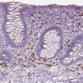 Anti-CD84 antibody produced in rabbit Prestige Antibodies® Powered by Atlas Antibodies, affinity isolated antibody, buffered aqueous glycerol solution