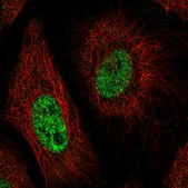 Anti-CNTNAP1 antibody produced in rabbit Prestige Antibodies® Powered by Atlas Antibodies, affinity isolated antibody, buffered aqueous glycerol solution