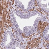 Anti-TINAGL1 antibody produced in rabbit Prestige Antibodies® Powered by Atlas Antibodies, affinity isolated antibody, buffered aqueous glycerol solution