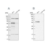 Anti-BAIAP2 antibody produced in rabbit Prestige Antibodies® Powered by Atlas Antibodies, affinity isolated antibody, buffered aqueous glycerol solution
