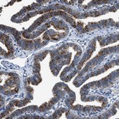 Anti-COX19 antibody produced in rabbit Prestige Antibodies® Powered by Atlas Antibodies, affinity isolated antibody, buffered aqueous glycerol solution