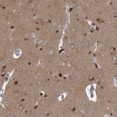 Anti-TRIM2 antibody produced in rabbit Prestige Antibodies® Powered by Atlas Antibodies, affinity isolated antibody, buffered aqueous glycerol solution