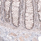 Anti-FOXM1 antibody produced in rabbit Prestige Antibodies® Powered by Atlas Antibodies, affinity isolated antibody, buffered aqueous glycerol solution