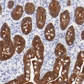 Anti-KRT19 antibody produced in rabbit Prestige Antibodies® Powered by Atlas Antibodies, affinity isolated antibody, buffered aqueous glycerol solution