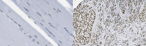 Anti-Pyrin from rabbit, purified by affinity chromatography