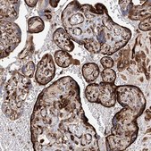 Anti-HGSNAT antibody produced in rabbit Prestige Antibodies® Powered by Atlas Antibodies, affinity isolated antibody, buffered aqueous glycerol solution