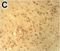 Anti-DNMT3B antibody produced in rabbit Prestige Antibodies® Powered by Atlas Antibodies, affinity isolated antibody, buffered aqueous glycerol solution