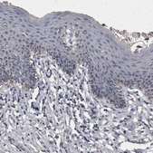 Anti-ACADM antibody produced in rabbit Prestige Antibodies® Powered by Atlas Antibodies, affinity isolated antibody, buffered aqueous glycerol solution