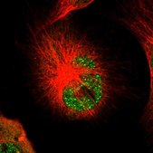 Anti-PSMC3 antibody produced in rabbit Prestige Antibodies® Powered by Atlas Antibodies, affinity isolated antibody, buffered aqueous glycerol solution
